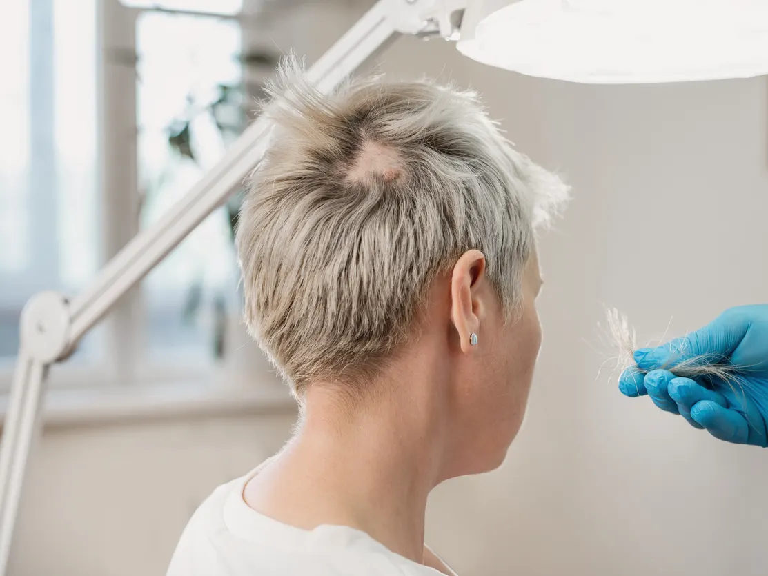 Stock photograph of models: a gloved clinician examines the short grey hair of a woman seen from behind