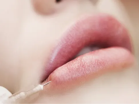 Stock photograph of a model: a gloved hand holds a fine needle at a woman's lower lip