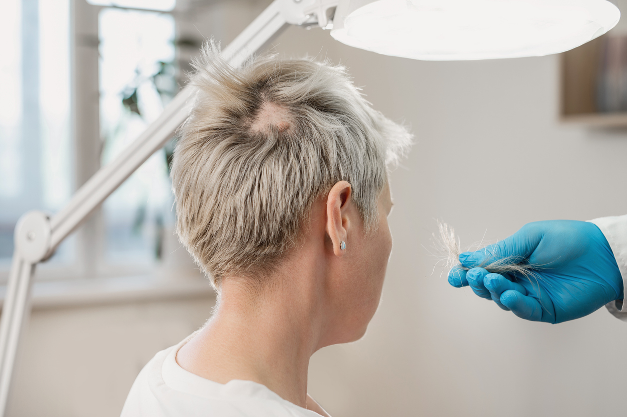 Stock photograph of models: a gloved clinician examines the short grey hair of a woman seen from behind
