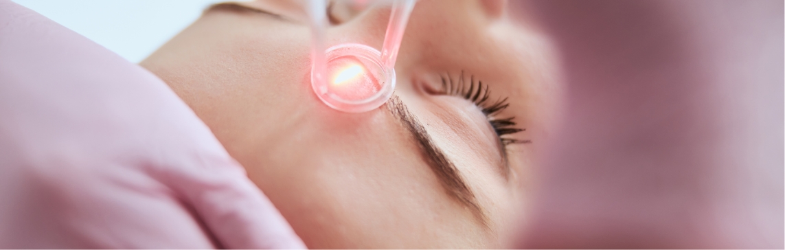 Stock photograph of a model: a pink-gloved hand holds a laser handpiece glowing red-orange above a reclining woman's cheek